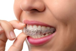 Philadelphia Invisalign; Philadelphia Dentist; Philadelphia Orthodontist; Philadelphia Orthodontics